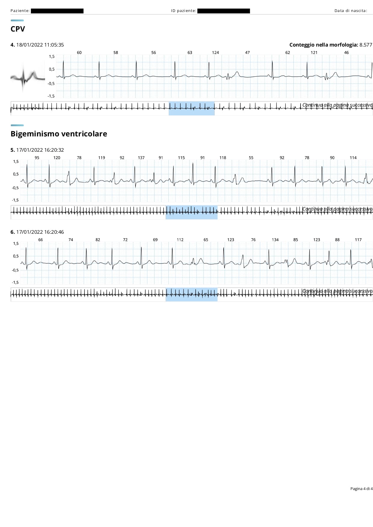 esempio referto ecg holter